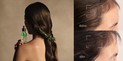 784051-KV-Hair-png-400x0-2 | SUPERADRIANME.com